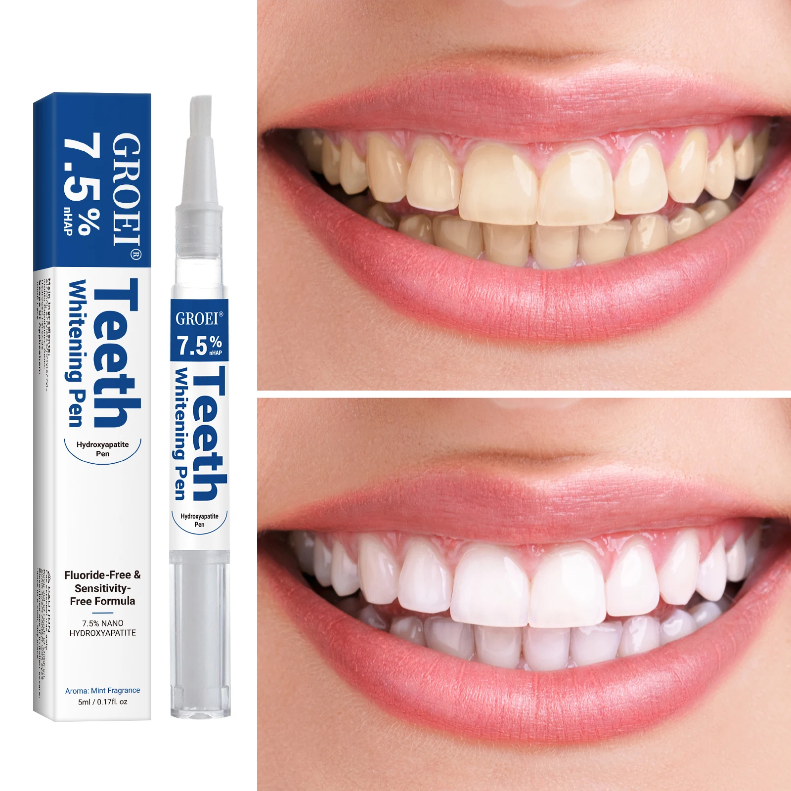 Hydroxyapatite Tooth Whitening - Teeth Whitening Near Me review and price