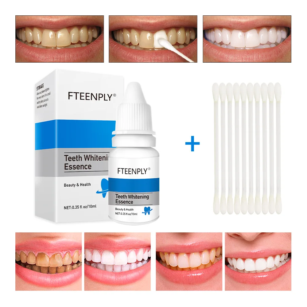 FTEENPLY Teeth Whitening Essen - Teeth Whitening Near Me review and price