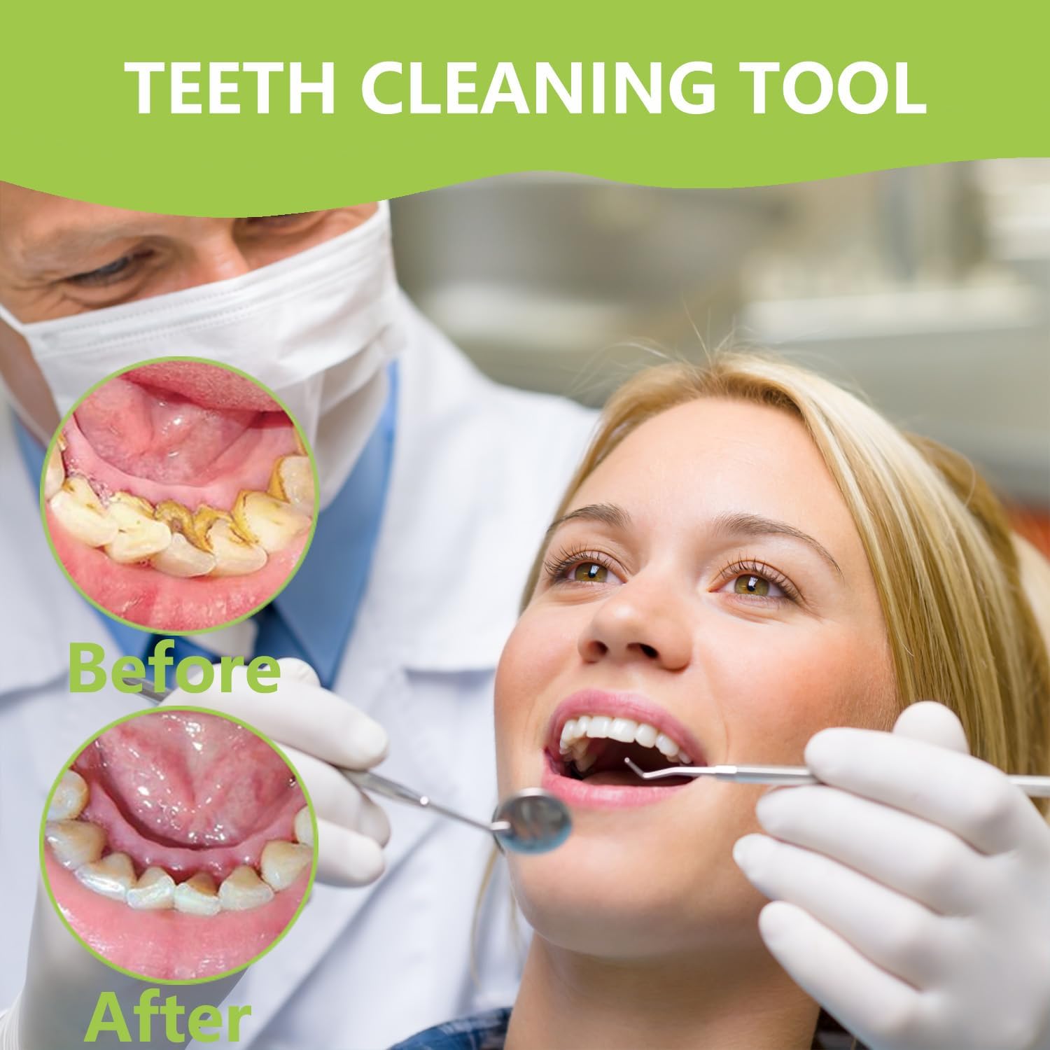 Professional Teeth Cleaning Or - Teeth Whitening Mouthwash review and price