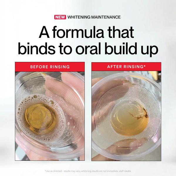 Hismile ID Whitening Stain Mou - Teeth Whitening Mouthwash review and price