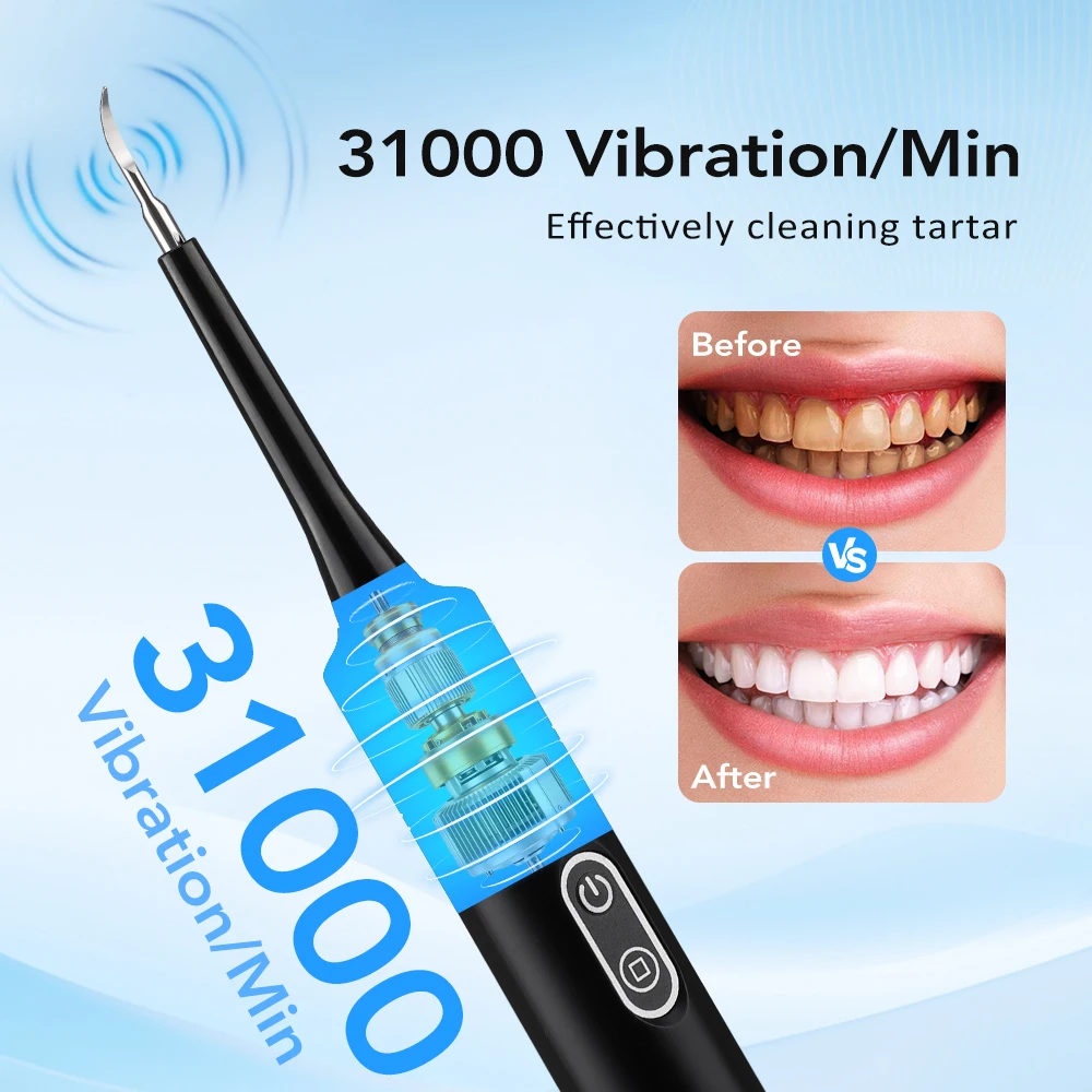 Electric Sonic Vibration Denta - Teeth Whitening Mouthwash review and price